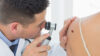 Untersuchung eines Muttermals durch einen Arzt mit einem Dermathoskop