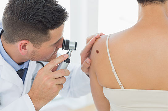Arzt untersucht Muttermal mit Dermatoskop